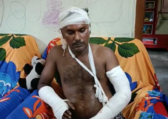 CPI-M Party Worker attempted to be Murdered in Capital City Agartala by Miscreants : Multiple Fractures, Wounds Received in an Organized Attack by 15 to 20 persons CPI-M Party Worker attempted to be Murdered in Capital City Agartala by Miscreants : Multiple Fractures, Wounds Received in an Organized Attack by 15 to 20 persons